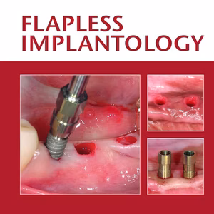 Flapless Implantology