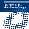 Fractures Of The Mandibular Condyle