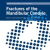 Fractures Of The Mandibular Condyle