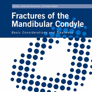 Fractures Of The Mandibular Condyle
