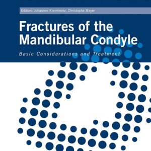 Fractures Of The Mandibular Condyle