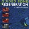 Guided Bone Regeneration Second Edition