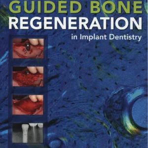 Guided Bone Regeneration Second Edition