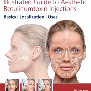 Illustrated Guide To Aesthetic Botulinumtoxin Injections