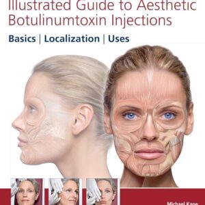 Illustrated Guide To Aesthetic Botulinumtoxin Injections