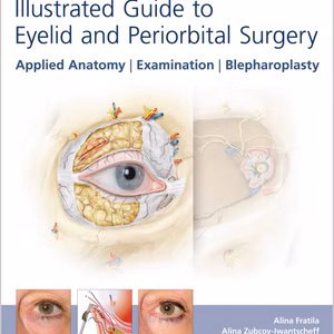 Illustrated Guide To Eyelid And Periorbital Surgery