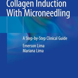 Illustrated Guide To Percutaneous Collagen Induction