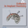 Immediate Function And Esthetic Implant Dentistry