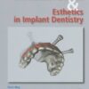 Immediate Function And Esthetic Implant Dentistry