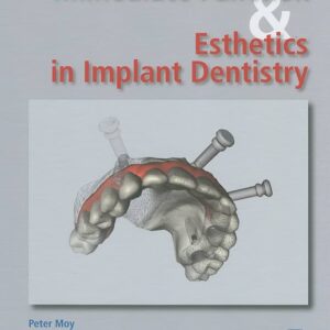 Immediate Function And Esthetic Implant Dentistry