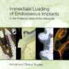 Immediate Loading Of Endosseous Implants