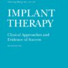 Implant Therapy – Clinical Approaches and Evidence of Success