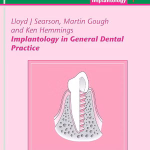 Implantology In General Dental Practice