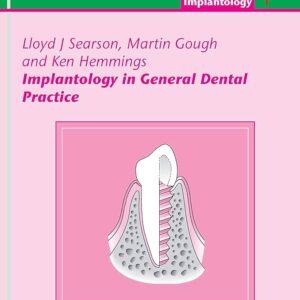 Implantology In General Dental Practice