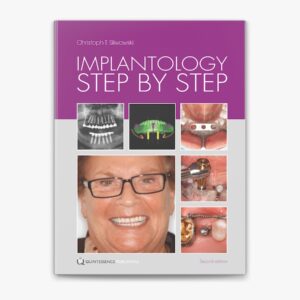Implantology Step By Step