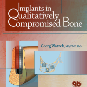 Implants In Qualitatively Compromised Bone