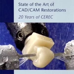 Int Symp Computer Restorations Cerec