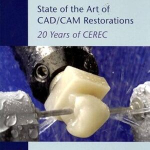 Int Symp Computer Restorations Cerec