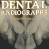 Interpreting Dental Radiographs