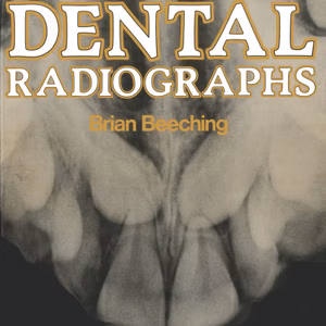 Interpreting Dental Radiographs