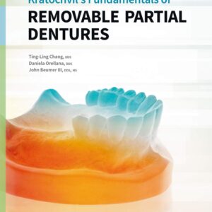 Kratochvil's Fundamentals of Removable Partial Dentures