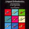 Lingual Orthodontics