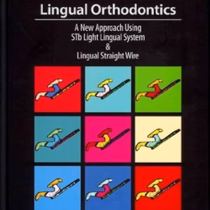 Lingual Orthodontics