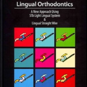 Lingual Orthodontics