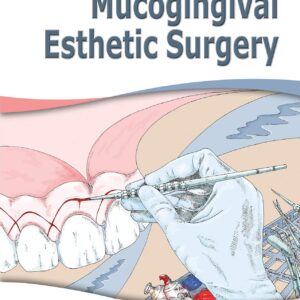 Mucogingival Esthetic Surgery