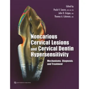 Noncarious Cervical Lesions And Cervical Dentin Hypersensitivity
