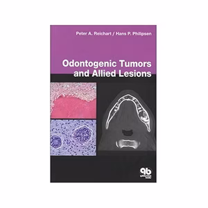Odontogenic Tumors & Allied Lesions