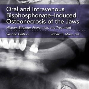 Oral And Intravenous Bisphosphonate-Induced Osteonecrosis Of The Jaws Second Edition