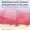 Oral & Intravenous Bisphosphonate-Induced Osteonecrosis Of The Jaws