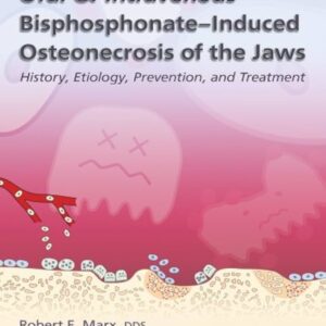 Oral & Intravenous Bisphosphonate-Induced Osteonecrosis Of The Jaws