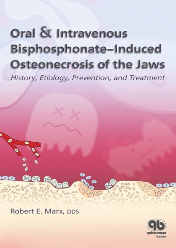 Oral & Intravenous Bisphosphonate-Induced Osteonecrosis Of The Jaws