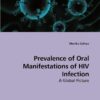Oral Manifestation Hiv Infection