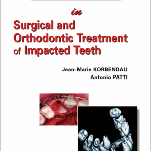 Orthodontic And Surgical Management Of Impacted Teeth