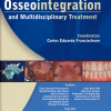 Osseointegration And Multidisciplinary Treatment