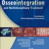 Osseointegration And Multidisciplinary Treatment