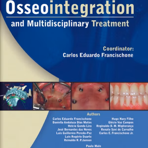 Osseointegration And Multidisciplinary Treatment