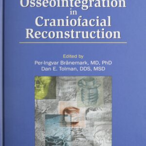 Osseointegration In Craniofacial Recon