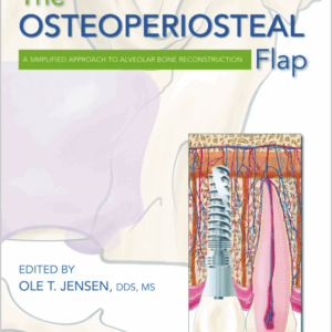Osteoperiosteal Flap