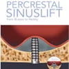 Percrestal Sinuslift- From Illusion To Reality