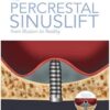 Percrestal Sinuslift- From Illusion To Reality