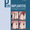 Peri-Implantitis