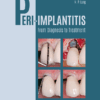 Peri-Implantitis