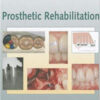 Prosthetic Rehabilitation