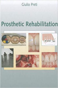 Prosthetic Rehabilitation