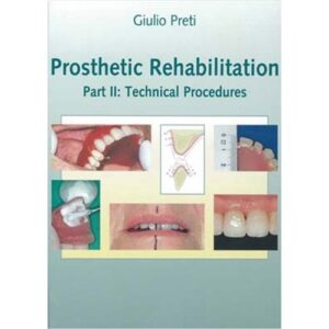 Prosthetic Rehabilitation: Part Ii Technical Procedures