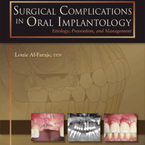 Surgical Complications In Oral Implantology: Etiology, Prevention And Management